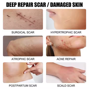 Gel de suppression des cicatrices ENWEI EW017, crème réparatrice de la peau à action rapide, pour hommes, femmes, adolescents, acné, chirurgie, vergetures, soin quotidien de la peau - Product Image 3