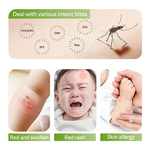 Gel Chanson para Aliviar la Picazón de las Mosquitos, Portátil para Exteriores, Gel Calmante Natural para Después de las Picaduras - Product Image 6