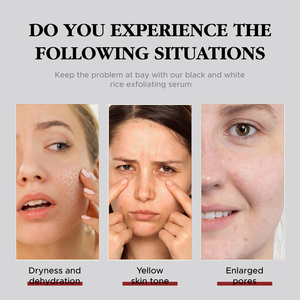 Exfoliante <span class=keywords><strong>Facial</strong></span> y Corporal Coreano para el Cuidado de la Piel, Ampolla de Arroz Negro Blanqueadora, Eliminador de Puntos Negros - Product Image 3