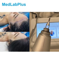 Nouvelle machine d'extraction de cheveux FUE portable avec extracteur de follicules 220V/110V 10000 tr/min