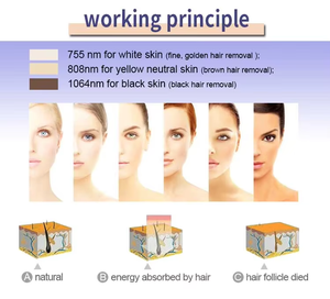 Macchina di Bellezza da Tavolo S.W per Rimozione Pigmenti, Rassodamento della Pelle, Depilazione con 2 Manipoli, Attrezzatura Estetica per Uso Domestico - Product Image 2