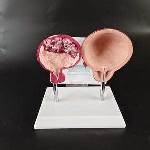 Comparación de Órganos Viscerales Normales con Corazón, Pulmón, Vejiga, Vasos, Tráquea Oral, Modelo Médico Fetal - Product Image 2