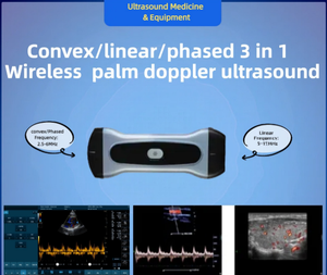 Dispositivo de Diagnóstico por Ultrasonido Portátil Eléctrico para Veterinarios y Humanos, en Oferta, para Práctica General, con Garantía - Product Image 1