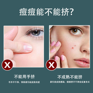 7 Piece Stainless Steel Acne Needle Set For Blackhead And Comedone Removal Face Cleaning Tool - Product Image 5