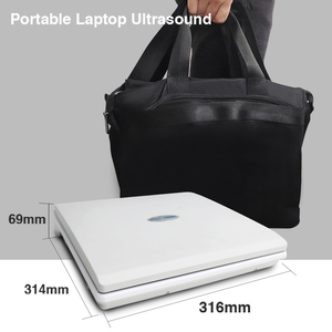 Mesin pemindai <span class=keywords><strong>Ultrasound</strong></span> Keyboard penuh, peningkatan baru diagnostik gema Notebook Digital B - Product Image 4