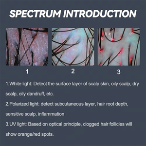 बाल विरोधी लॉस एलसीडी स्क्रीन बाल खोपड़ी और त्वचा विश्लेषक मशीन बाल तेल और नमी विश्लेषण सौंदर्य व्यक्तिगत देखभाल उत्पाद - Product Image 5