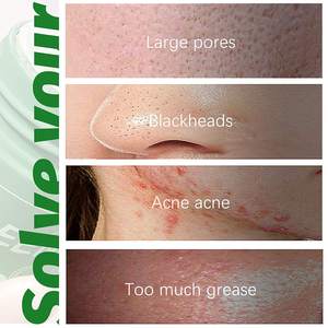 <span class=keywords><strong>Masque</strong></span> de thé vert purifiant, pour hommes et femmes, étiquette privée, soins pour la peau, <span class=keywords><strong>masque</strong></span> en <span class=keywords><strong>argile</strong></span> purifiant, Anti-acné, dissolvant de points noirs,, OEM/ODM - Product Image 5