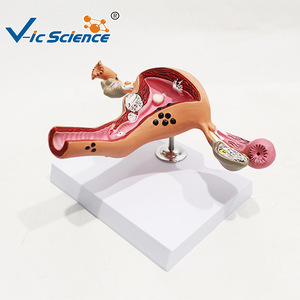 Modelo patológico uterino femenino humano; modelo de demostración para enseñanza y formación médica ginecológica; material didáctico de anatomía. - Product Image 2