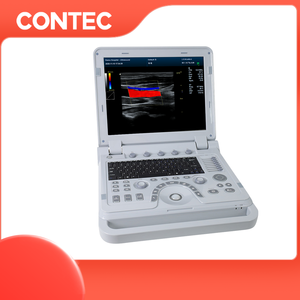 CONTEC CMS1700B mesin <span class=keywords><strong>ultrasound</strong></span> 3D, mesin <span class=keywords><strong>ultrasound</strong></span> ultrasonik ultrasonik jantung - Product Image 4