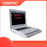 Appareil d'échocardiographie CONTEC CMS1700B Échocardiogramme Échographie Doppler couleur portable