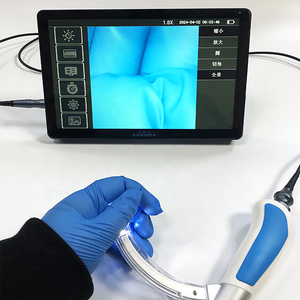 नैदानिक पोर्टेबल एंडोस्कोप राइनगोस्कोप डिजिटल वीडियो एंडोस्कोप लचीला वीडियो एंडोस्कोप ब्रोंकोस्कोप - Product Image 6