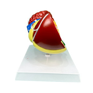 Modèle d'anatomie hépatique pathologique Structure hépatique malade avec cirrhose et lésions tumorales pour l'enseignement médical et la formation chirurgicale - Product Image 6