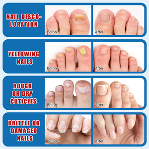 Commercio all'ingrosso con unghie Private Label trattamento per funghi Extra forza soluzione per la rimozione di funghi per unghie e unghie per riparare il siero per unghie - Product Image 3
