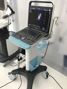 CE ISO disetujui sonobape <span class=keywords><strong>S8exp</strong></span> warna Doppler portabel mesin Ultrasound plastik elektrik dengan layar LED 15 inci untuk rumah sakit - Product Image 6