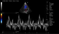 AMAIN Vet Machine à ultrasons Doppler couleur de haute qualité avec système d'échographie vétérinaire en mode PW pour animaux