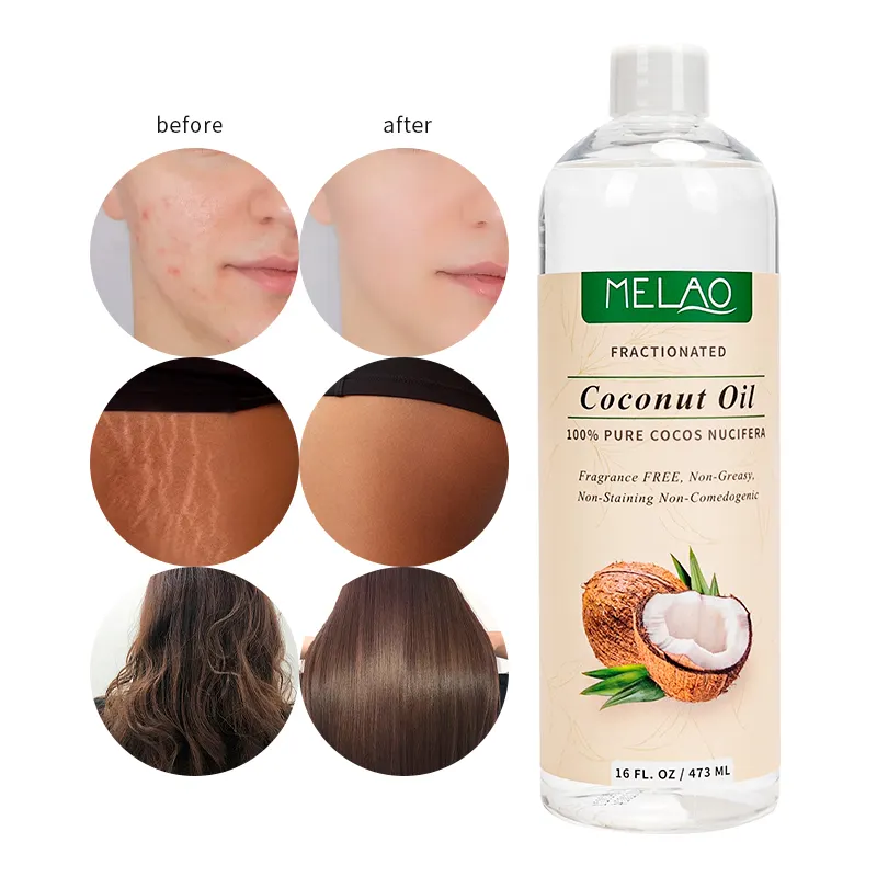 Óleos essenciais para relaxamento, óleo orgânico puro de côco, massageador com dilutagem e óleo para pele ou cabelo 16oz