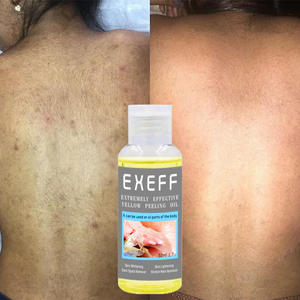 น้ำมันเซรั่มน้ำมันสำหรับเซรั่มบำรุงผิวเพื่อผิวขาวกระจ่างใส - Product Image 1