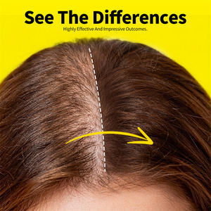 Corrector de Cabello en Polvo, No Graso, para Disimular la Línea del Cabello, Polvo para Dar Volumen, Retoque de Raíz para Mujeres con Pérdida de Cabello - Product Image 5