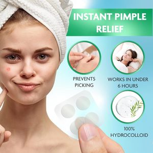 Chiaro 4 toppe <span class=keywords><strong>per</strong></span> foglio di forma rotonda brufolo di <span class=keywords><strong>acne</strong></span> patch con custodia in plastica con specchio - Product Image 5