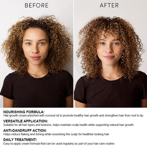 Luxfume Engrais capillaire Traitement antipelliculaire du cuir chevelu Renforce Conditionne Favorise la croissance saine des cheveux et renforce les cheveux - Product Image 3