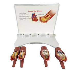 कोरोनरी हृदय रोग के लिए शैक्षिक उपकरण 4-चरण स्टेंट तैनाती प्रदर्शन मॉडल - Product Image 6