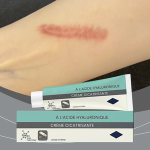 Creme Hidratante Corporal com Ácido Hialurônico, Suave, Não Pegajoso, Confortável, Suaviza e Rejuvenesce, Uso Diário para Todos os Tipos de Pele - Product Image 5