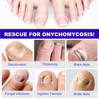 Meilleure Vente : Traitement des Ongles Antifongique à l'Hydrogel (21 Patchs) – Soin Réparateur des Ongles des Pieds, Renouvellement Nocturne, Patchs Antifongiques pour Ongles Abîmés