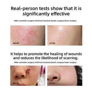 <span class=keywords><strong>Crema</strong></span> Rassodante Collo e <span class=keywords><strong>Viso</strong></span> Illuminante Anti-Età <span class=keywords><strong>Uomo</strong></span> con Collagene Ricombinante e Peonia - Potenza Giovanile <span class=keywords><strong>Idratante</strong></span> per Cura Quotidiana - Product Image 4