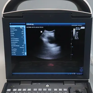 Mindray DP 10 Ultrasound Machine Laptop Mindray Ultrasound Portable Ultrasound Machine