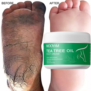 Crema para Pies con Aceite de Árbol de Té, OEM, Venta al Por Mayor, Marca Privada, Productos para el Cuidado de la Piel, Suaviza y Tonifica la Piel Seca y las Callosidades, 250g - Product Image 1