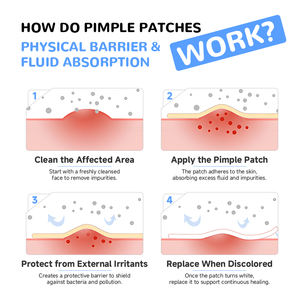 16 पैच फूल का रंग लड़कियों के लिए प्यारा डिजाइन हाइड्रोकोलाइड पिम्पल पैच के लिए चेहरे की कोरियन शैली के लिए - Product Image 5