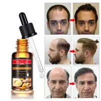 Óleo de crescimento rápido do cabelo 50ml, óleo herbal para crescimento e fortalecimento do cabelo