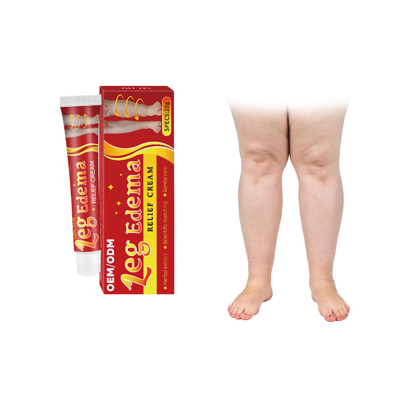 OEM ODM Natural Herbal Body Health Care Ointment Cream for Eliminating Edema and Swelling Health Supply