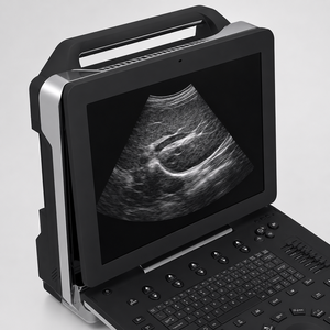 Appareil d'échographie Doppler couleur haute définition LTUB52 pour l'imagerie abdominale, <span class=keywords><strong>cardiaque</strong></span> et générale - Product Image 5