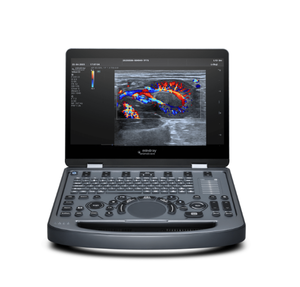 Système d'échographie vétérinaire portable d'entrée de gamme Mindray Vetus E3, classe II, certifié CE, garantie d'un an - Product Image 1