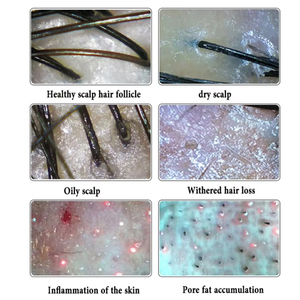 Analisador de Cabelo para Cuidado do Crescimento Capilar, Câmera de Couro Cabeludo, Tricoscópio, Máquina de Análise de Folículos Capilares - Product Image 6