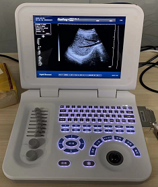 دفتر <span class=keywords><strong>S30</strong></span> الأكثر مبيعًا للموجات فوق الصوتية الطبية B/W S50A بالموجات فوق الصوتية ثنائي الأبعاد للحمل النسائي USG - Product Image 3