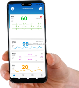 अस्पताल चिकित्सा उपकरण रोगी <span class=keywords><strong>icu</strong></span> एम्बुलेंस बहु-पैरामीटर रिमोट मल्टीपैरामीटर मॉनिटर - Product Image 4