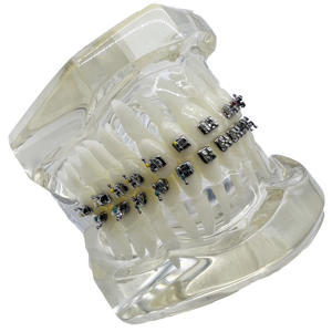 Yamei ortodontico 10000set a buon mercato tipo caldo dentale ortodontico Roth staffa Roth MBT Edgewise Wire taglio staffe (20 pz/carta) - Product Image 4