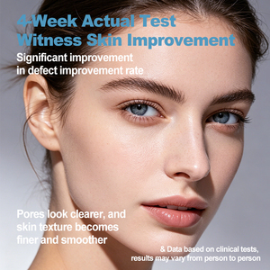 Suero para el Tratamiento del Acné con Mejora de la Piel en 4 Semanas, Reduce el 90% de las Imperfecciones de la Piel, Refina los Poros y Suaviza la Piel Áspera - Product Image 3