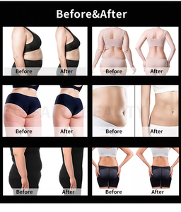 Máy Tạo Hình Thân Thể Hai Tay Cầm EMS <span class=keywords><strong>RF</strong></span> Giảm Mỡ Tăng Cơ Giảm Cân Máy Kích Thích Cơ Bắp Máy Giảm Béo - Product Image 6