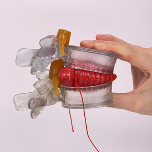Lumbar Spine Model Intervertebral Disc Model Diseased Lumbar Spine Model - Product Image 5