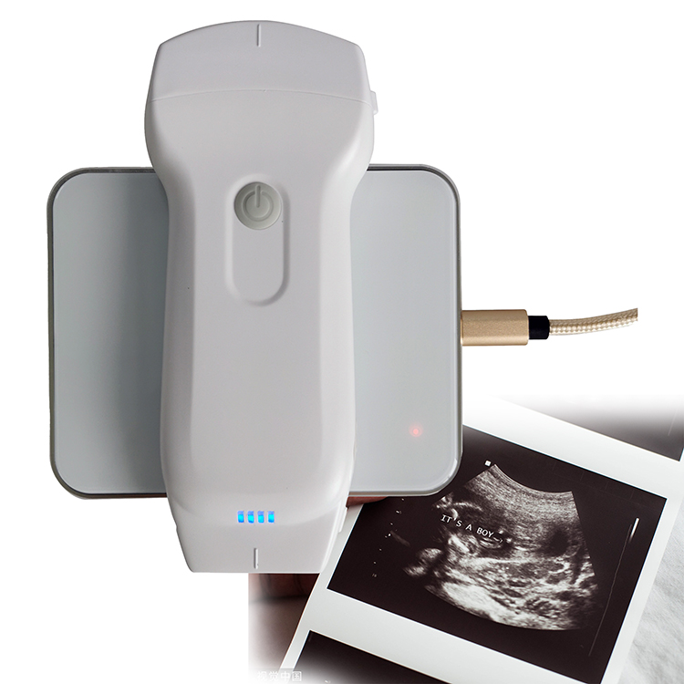 Highest Cost-Effective Double Probes Wireless Color Doppler Ultrasound Scanner Wireless Linear Ultrasound Probe