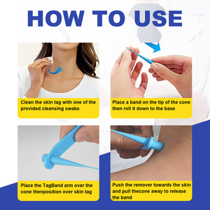 Kit Fácil para Eliminar Verrugas Cutáneas, Dispositivo de Eliminación de Verrugas sin Cirugía ni Desorden para Cara, Cuello y Cuerpo, Herramienta Eficaz para el Cuidado de la Piel - Product Image 2
