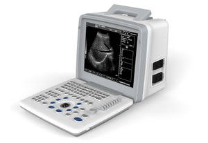 Mesin ultrasound laptop portabel & Murah hitam putih pemindai ultrasound mesin pemindai ultrasound resolusi tinggi - Product Image 2