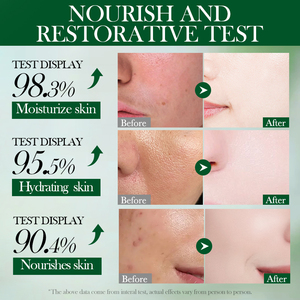 Le nouveau masque hydratant et nourrissant à l'avocat SADOER hydrate et répare naturellement la peau du visage, produits de soin de la peau - Product Image 6