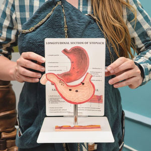 Modèle d'enseignement médical Modèle de démonstration d'évolution de l'estomac pathologique, outil anatomique en PVC pour la formation en gastroentérologie - Product Image 6