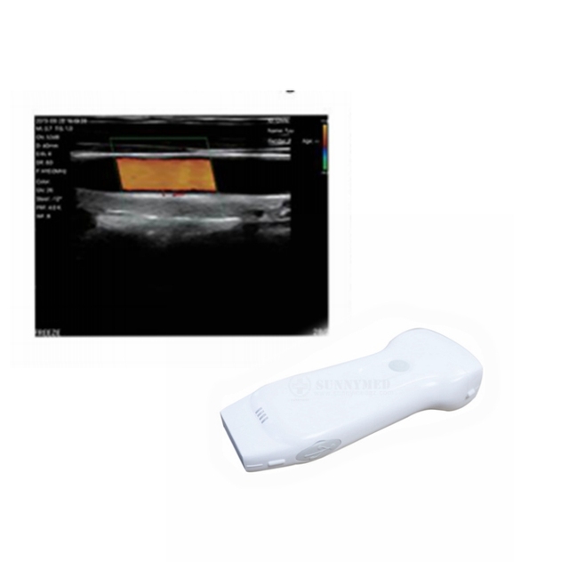 Highest Cost-effective Wireless Color Doppler Linear/Convex/Phased Array Probe 3 in 1 Pocket Ultrasound Scanner Probe