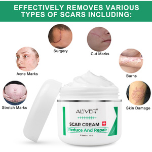 Crème pour le visage Aliver, crème pour éliminer les cicatrices, pour améliorer les cicatrices de brûlures, réduire la pigmentation, améliorer les cicatrices d'acné - Product Image 3
