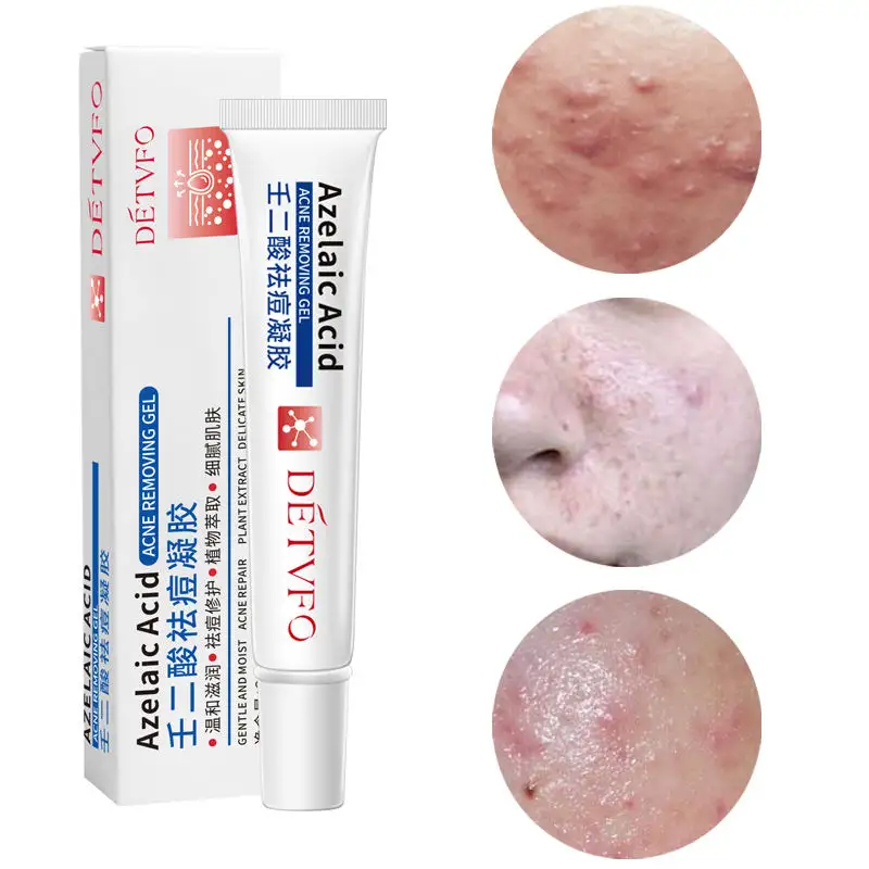 Effective azelaic acid anti acne treatment gel dispel acne repair delicate skin acne removal gel with no marks